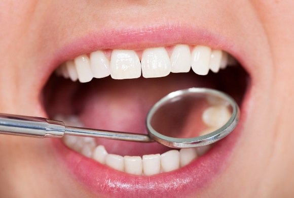 Dentist examining smile after metal free dental restoration