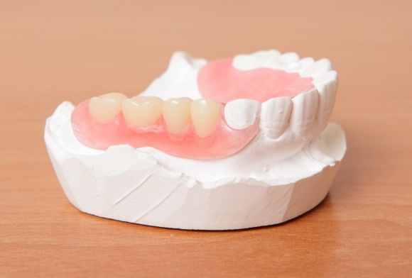 Model smile with partial denture