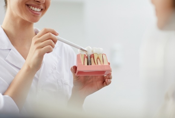 Dentist holding dental implant model and answering frequently asked questions