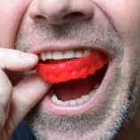 Man placing mouthguard to protect dental implant supported replacement teeth