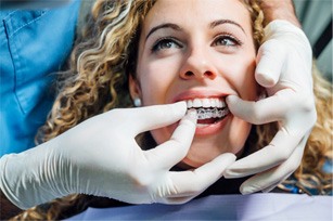 A dentist placing Invisalign aligners on a woman’s teeth