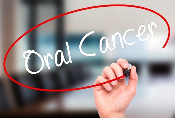 Oral cancer screening written on clear surface