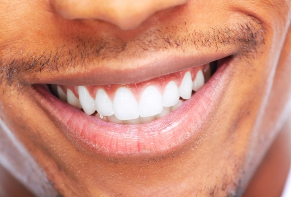 Closeup of healthy smile after pocket irrigation