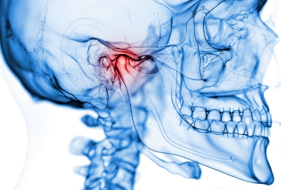 Animated jaw and skull bone indicating location of T M J disorder