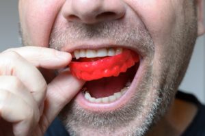 a man placing a protective mouthguard in his mouth before physical activity